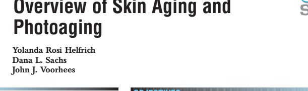 Overview of Skin Aging and Photoaging